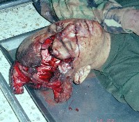 Asesinado por los terroristas de las FARC