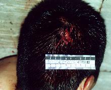 Patrullero Florez asesinado por las FARC