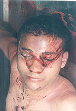 Soldado Hermes A. Ordóñez Campo  asesinado por terroristas de las FARC