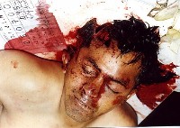 Agente Torres asesinado por las FARC