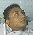 Soldado Profesional Vladimir Canchala, herido por una mina