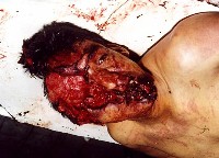 Subintendente Urbina asesinado por las FARC